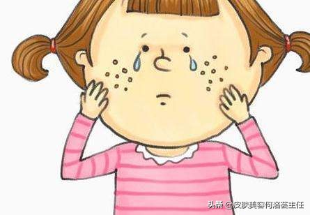 多磺酸粘多糖乳膏能祛顽固痘印吗,顽固痘印控制不长痘的话多久能消