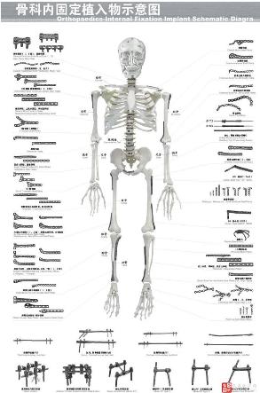 脑血管核磁共振具体检查过程,脑血管核磁共振前要注意什么
