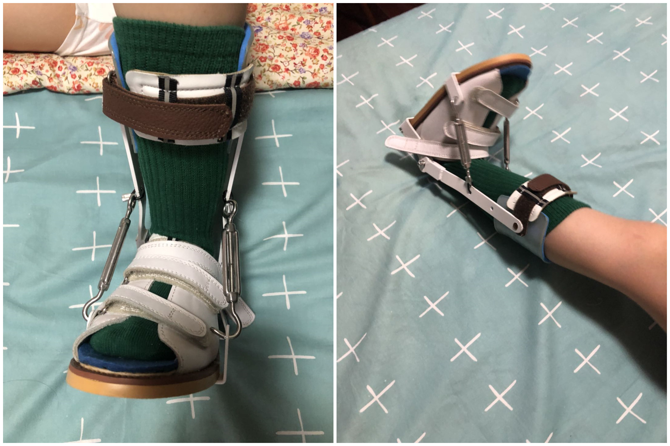 医院推荐儿童足外翻矫正鞋,脑瘫尖足矫正鞋