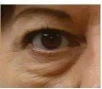 罗志祥的黑眼圈到底是怎么回事,罗志祥同款黑眼圈是什么意思