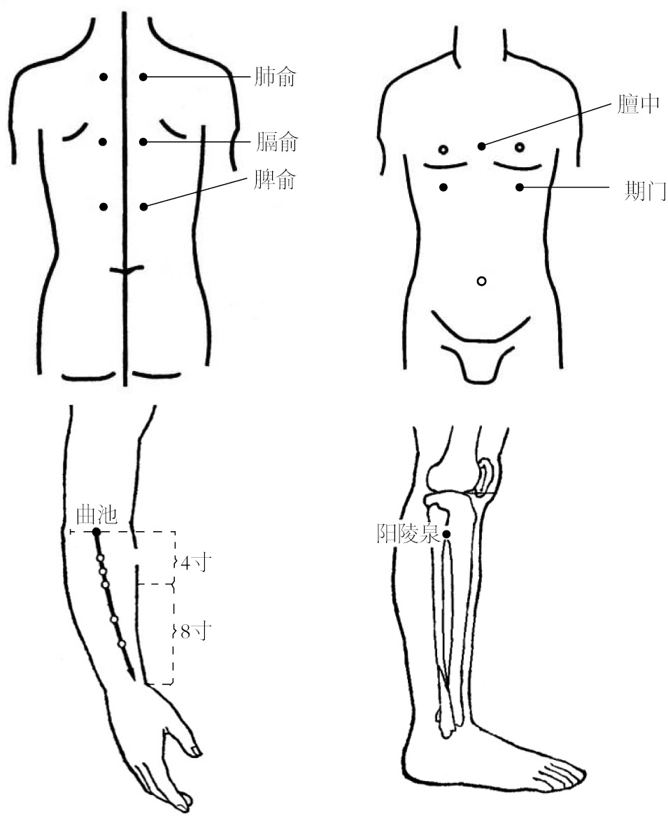 胸膜炎的位置在身体的哪个部位,胸膜增厚是胸膜炎的愈合阶段吗
