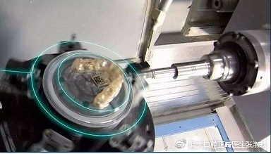 隐形牙套的效果和钢牙效果一样吗,传统牙套和隐形牙套哪个效果好