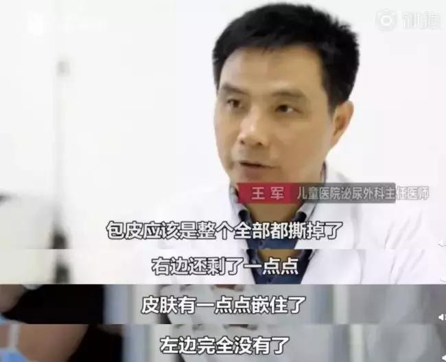 女童穿衣太潮患上妇科病,一岁女宝宝得了妇科病