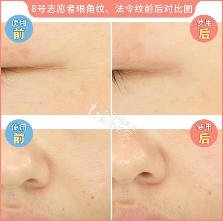 测评家用美容仪真的有用吗,网红推荐的美容仪有用吗