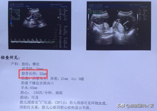 胎儿股骨长不够怎么办,胎儿股骨和肱骨不长