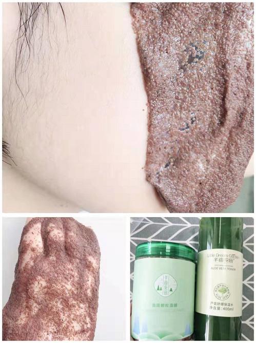 长痘期间推荐的面膜,拯救不闷痘的面膜