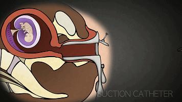 暑假变“人流假”，疯狂的不只成年人，还有12岁女学生