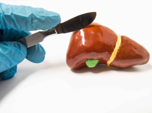 肝不好后背大面积起红斑,肝不好皮肤小红斑