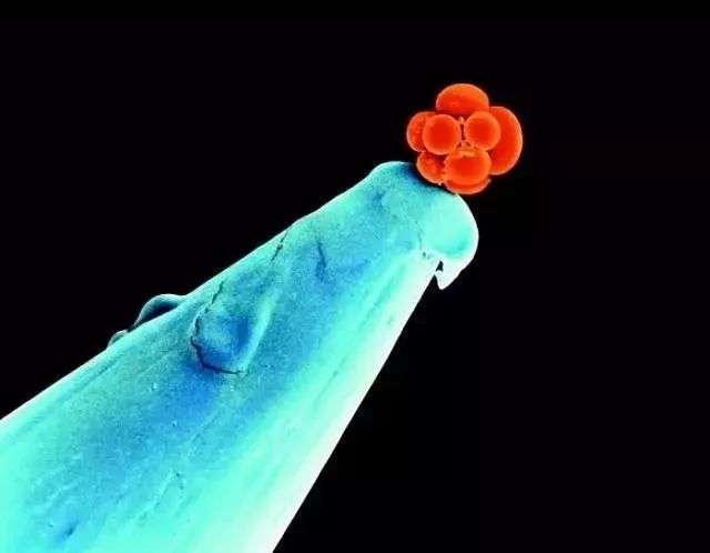 珠峰顶部岩石,珠峰顶部什么样子