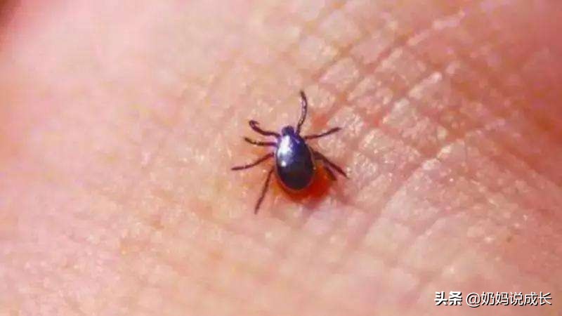 男孩“*处私**被咬”差点危及生命，要命的“*虫病恙**”家长要引起重视