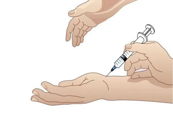 患了传说中的“妈妈手”怎么办，狭窄性腱鞘炎治疗看这里