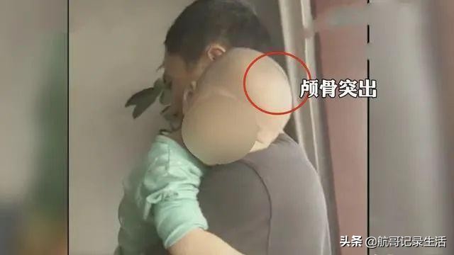 三鹿奶粉事件大头娃现在怎样了,三鹿奶粉事件和大头娃娃事件