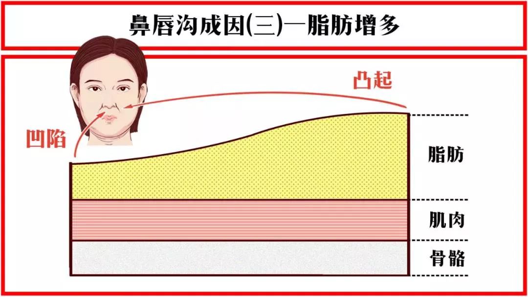 法令纹显老10岁三种方法帮助改善,最显老的法令纹怎么改善