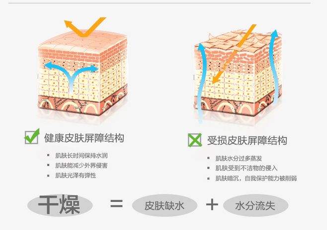 皮肤干燥发痒怎么改善,皮肤干燥黑暗怎么改善