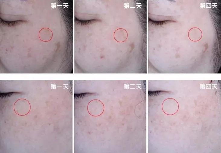 经常这样喝让你的脸色红润还养颜,每天坚持这样喝皮肤又白又嫩