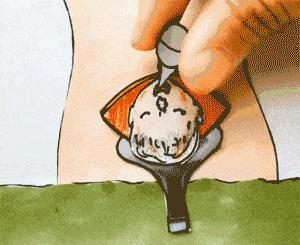 你想剖腹产，为什么医生总劝你自己生？