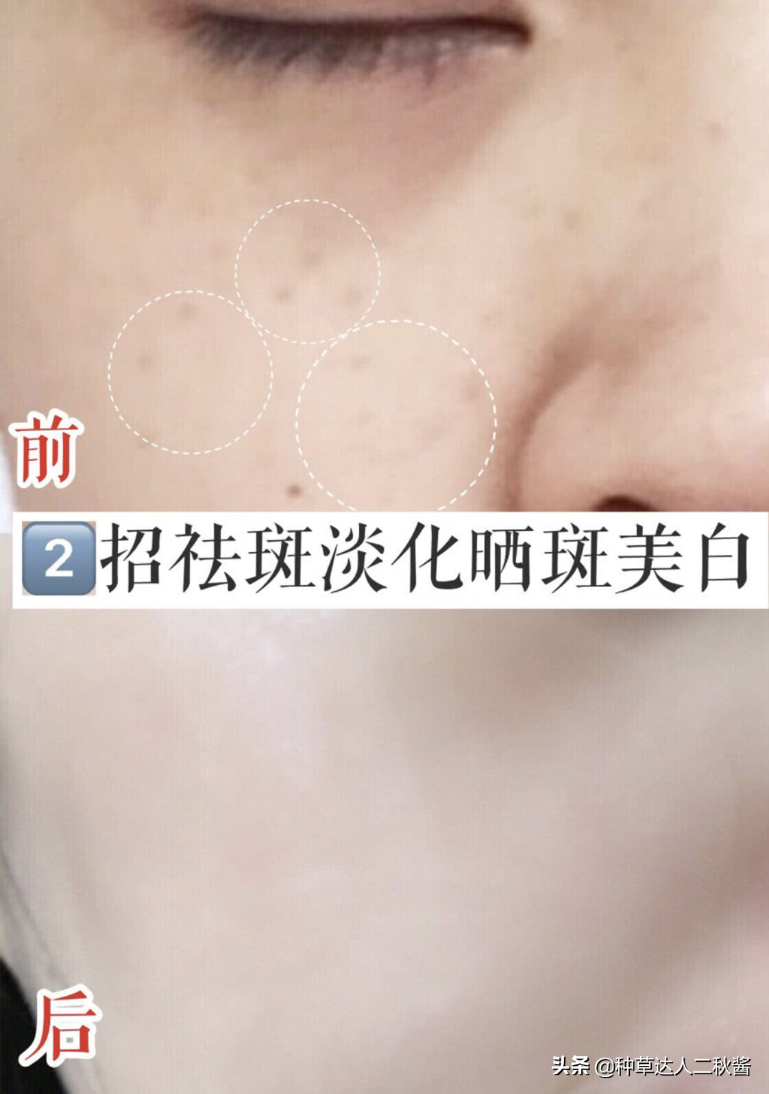 男士毛孔粗大出油黑头用什么护肤,毛孔粗大皮肤干如何正确护肤