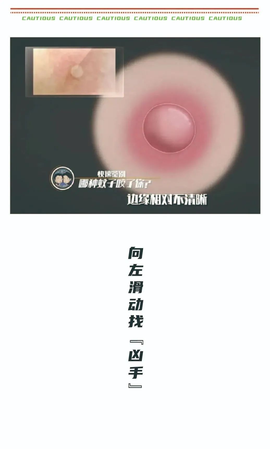 一年四季容易被蚊子咬是什么原因,被蚊子咬了正确打开方式