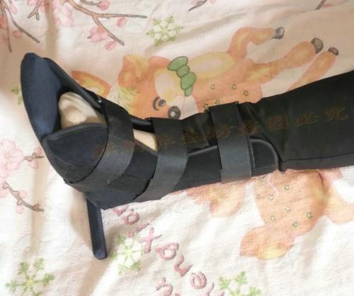 老年人肱骨骨折后该不该手术治疗,老人骨折的症状和治疗方法