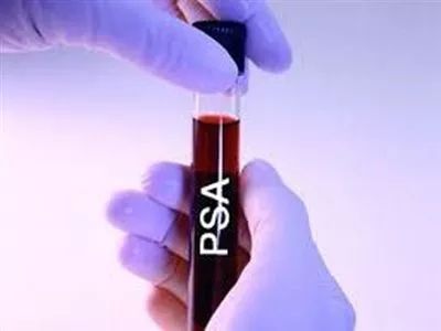 曝光现在体检行业乱象,体检行业黑幕后续