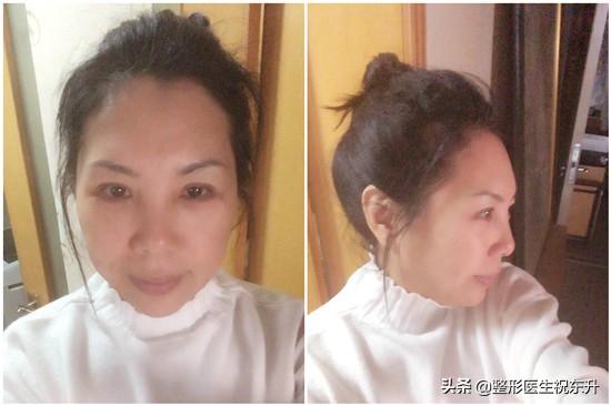 眼袋大用什么化妆品能修复,眼袋大怎么办用什么护肤品好