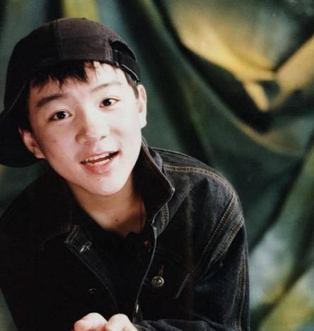 “三毛”34岁了！8岁爆火，14岁谢顶，植发挨300多针，如今变帅哥