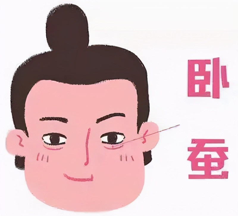 如何分清楚卧蚕泪沟眼袋黑眼圈,眼袋卧蚕和泪沟有什么区别