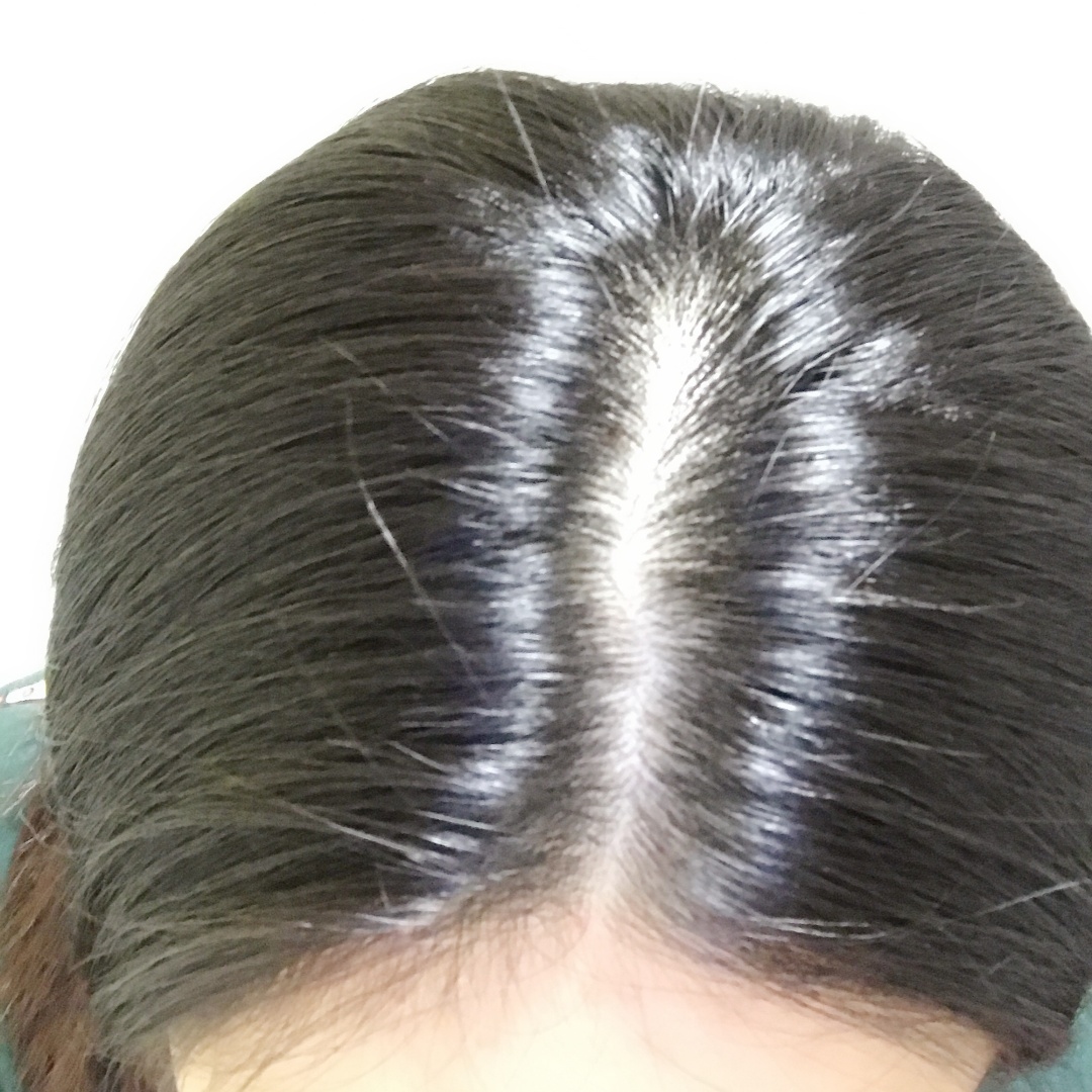 氨基酸洗发水有哪些功效养发,氨基酸养发洗发水