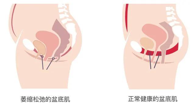 女生怀孕如何最有效处理,怀孕女生要面对什么