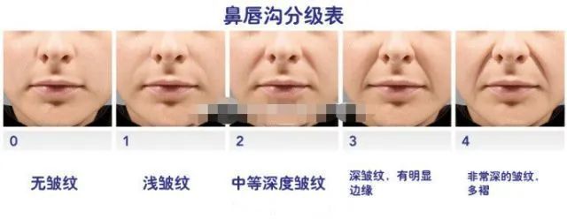 一次解决法令纹的方法,改善法令纹一看就学会