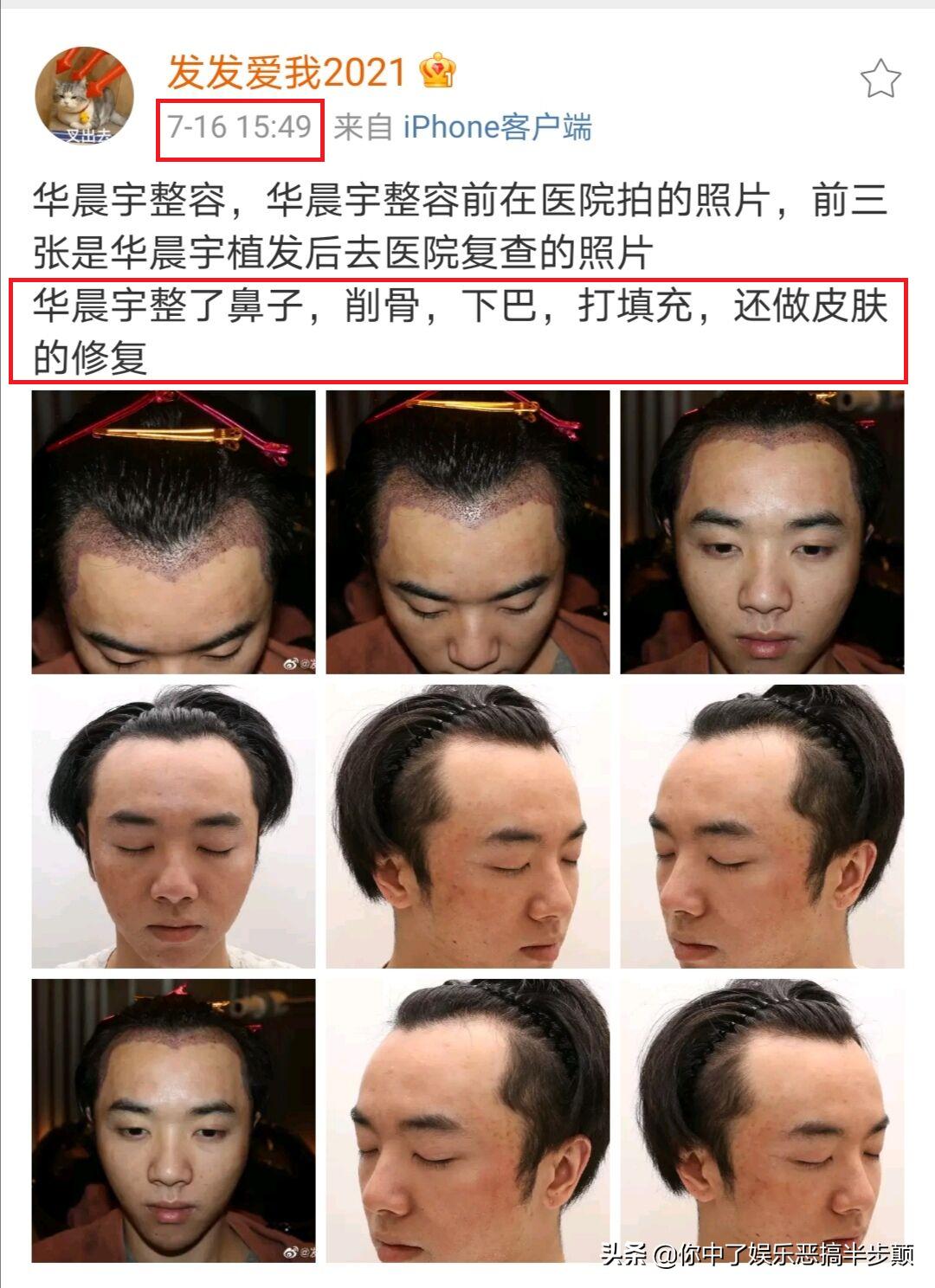 网友晒视频照片爆料华晨宇劈腿整容，华晨宇回应：将取证追责