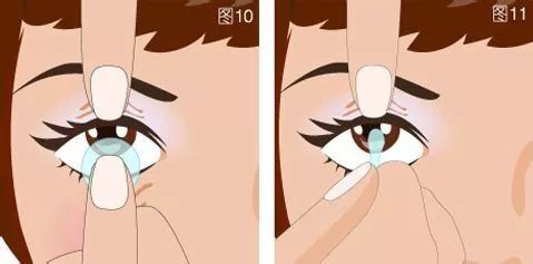 硅水凝胶隐形眼镜怎么摘,做了美甲怎么摘隐形眼镜