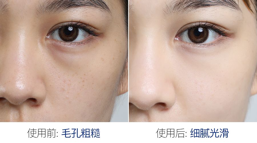 “神奇面膜”被疯抢！一片藏了8小时“美容觉”，醒来皮肤嫩透白