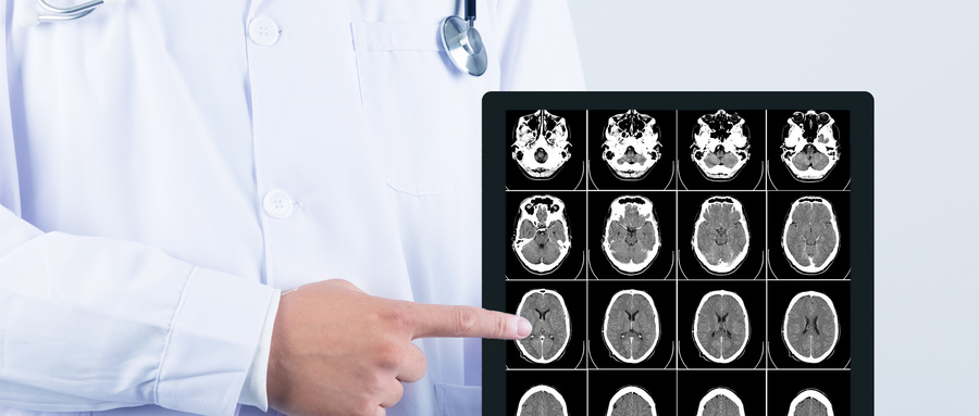 运动神经元病的10种类型,出现五个症状要警惕