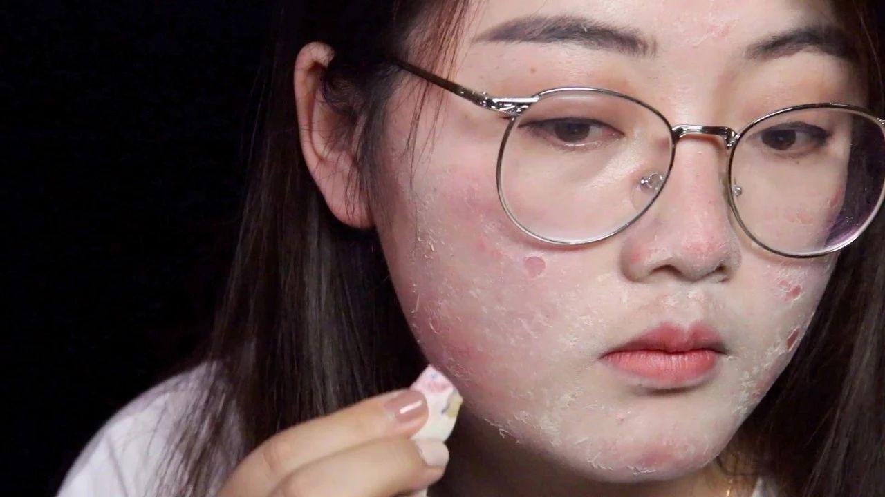 女生最怕“1孔1黑”，特别影响颜值，很多人女生中招还不自知