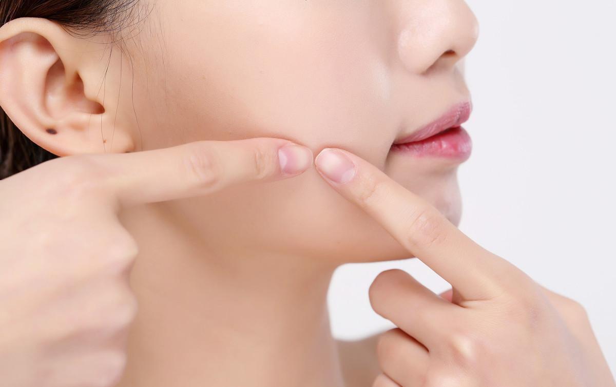 后背痘印怎么去除最快方法,后背痘印做激光可以祛除吗