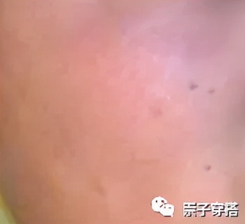 男生刷酸正确的护肤步骤,洗脸护肤的正确步骤男生