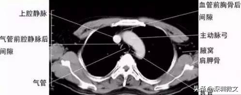 核磁共振原理和ct有什么区别,x光核磁ct的区别图片