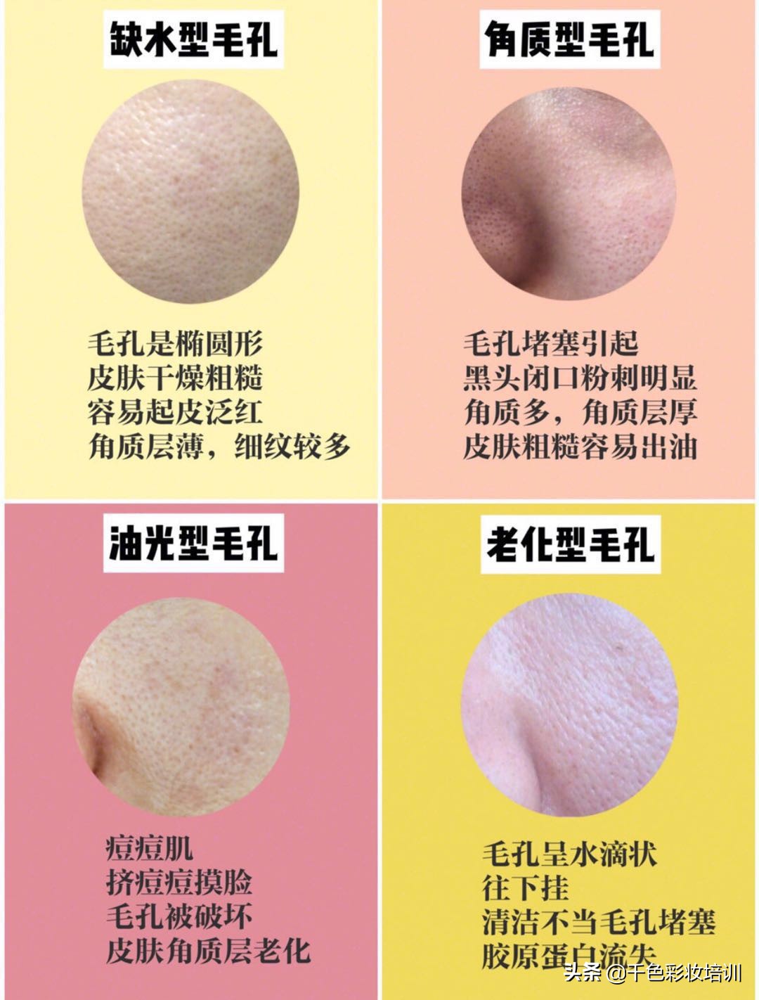 毛孔粗大怎么办怎么有效收缩毛孔,毛孔粗大怎么办教你几招收缩毛孔