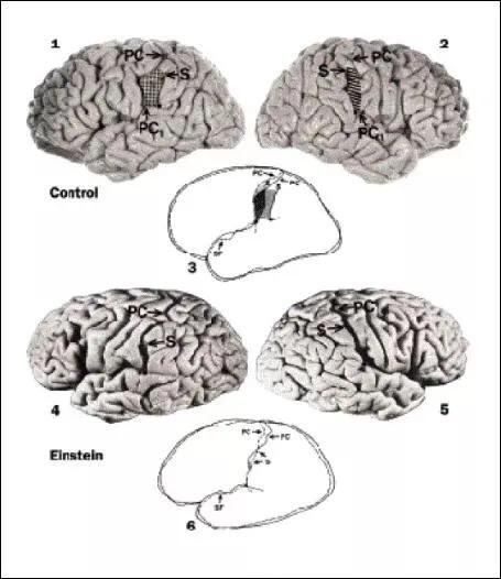 爱因斯坦的大脑vs正常人的大脑,爱因斯坦的大脑和人类的大脑