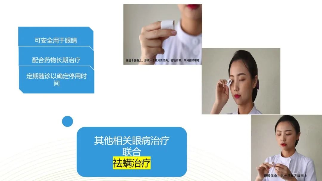 眼睛总是痒？总感觉眼睛里有东西？结膜炎角膜炎反反复复？可能是你的眼睛里有螨虫
