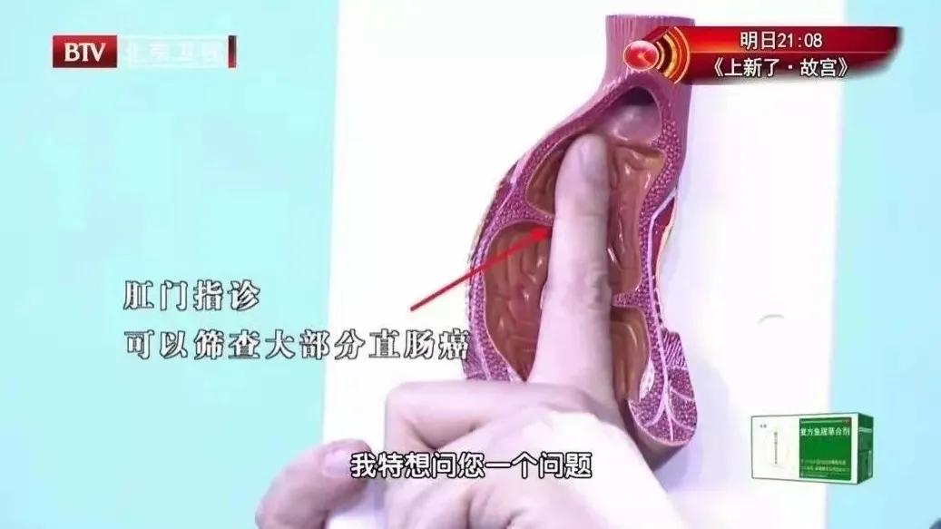 大便拉不干净的解决方法,大便擦不干净是什么原因怎么治疗