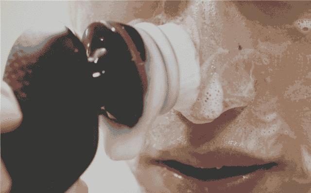 鼻子上用力挤挤出来白色东西很臭,鼻子里面有小鼓包挤出来白色很臭