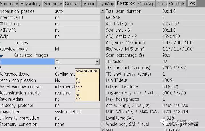 心脏磁共振定位方法,心脏磁共振各参数分析