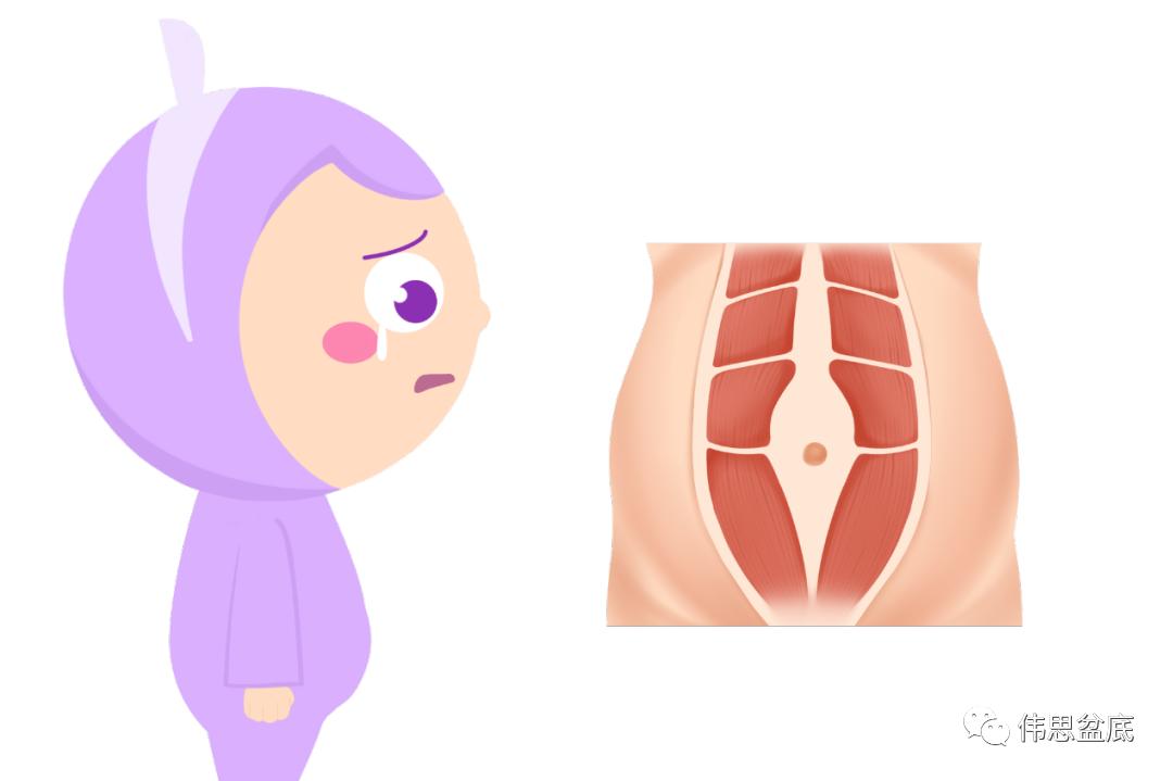 产后3年做腹直肌修复还有效果吗,产后3年做腹直肌修复还有用吗