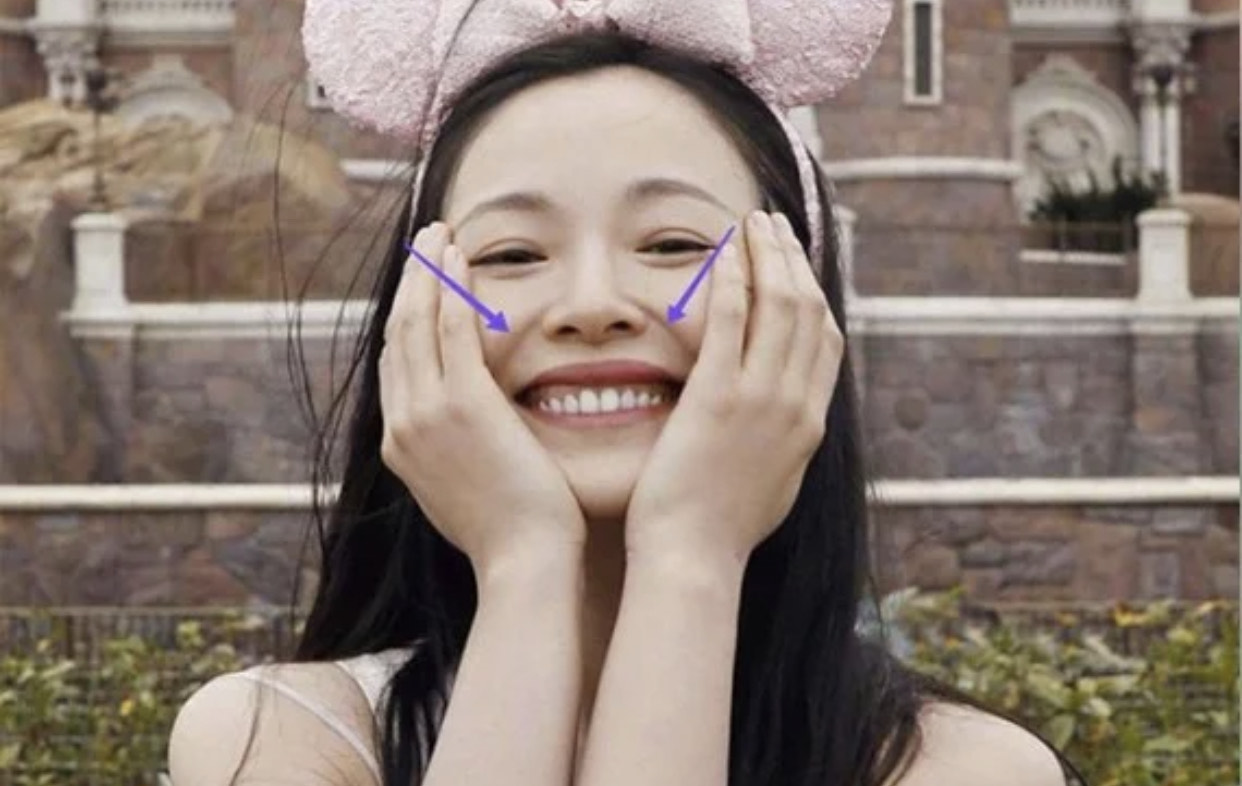 一笑眼下就有皱纹怎么办,从脸部看皱纹怎么才算老