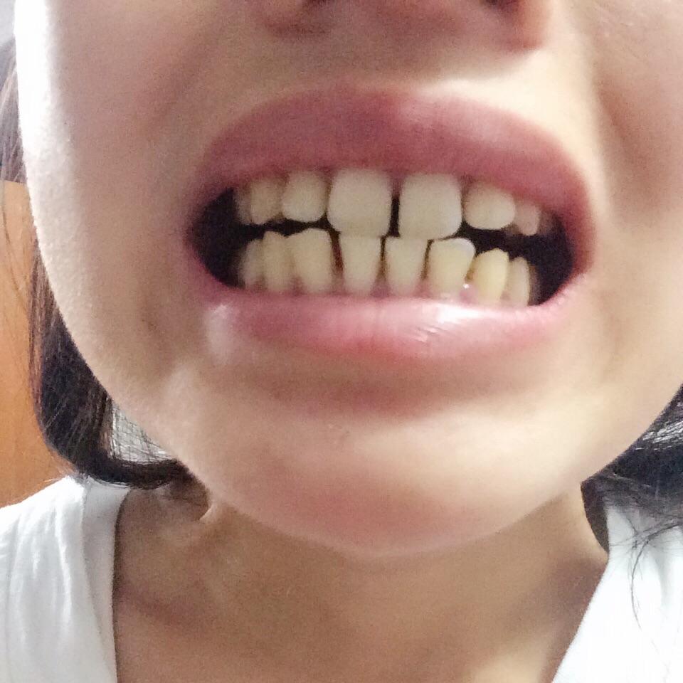 牙缝大漏财怎么补救,男孩牙缝宽有福还是漏财