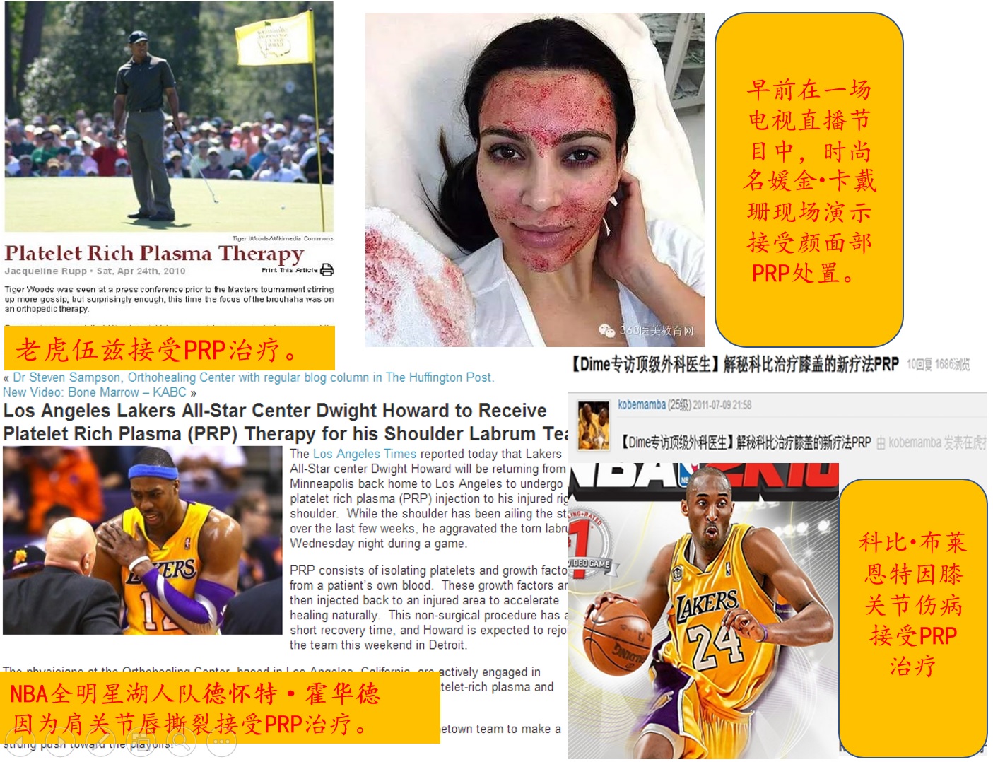 PRP治疗术——超级巨星也选择的的自体策划再生疗法