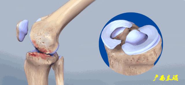 听骨科医生讲的话,听完骨科专家的一段话