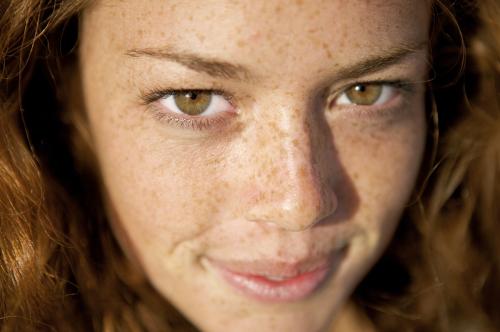 30岁以后脸上有斑怎么护理,怎样区分脸上的是斑还是痣